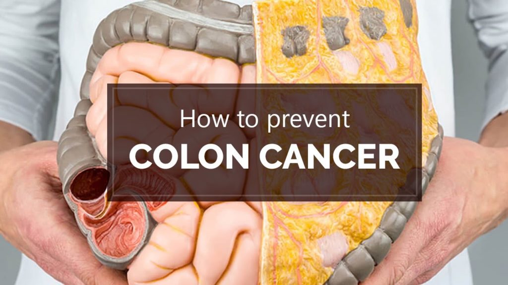 colon-cancer